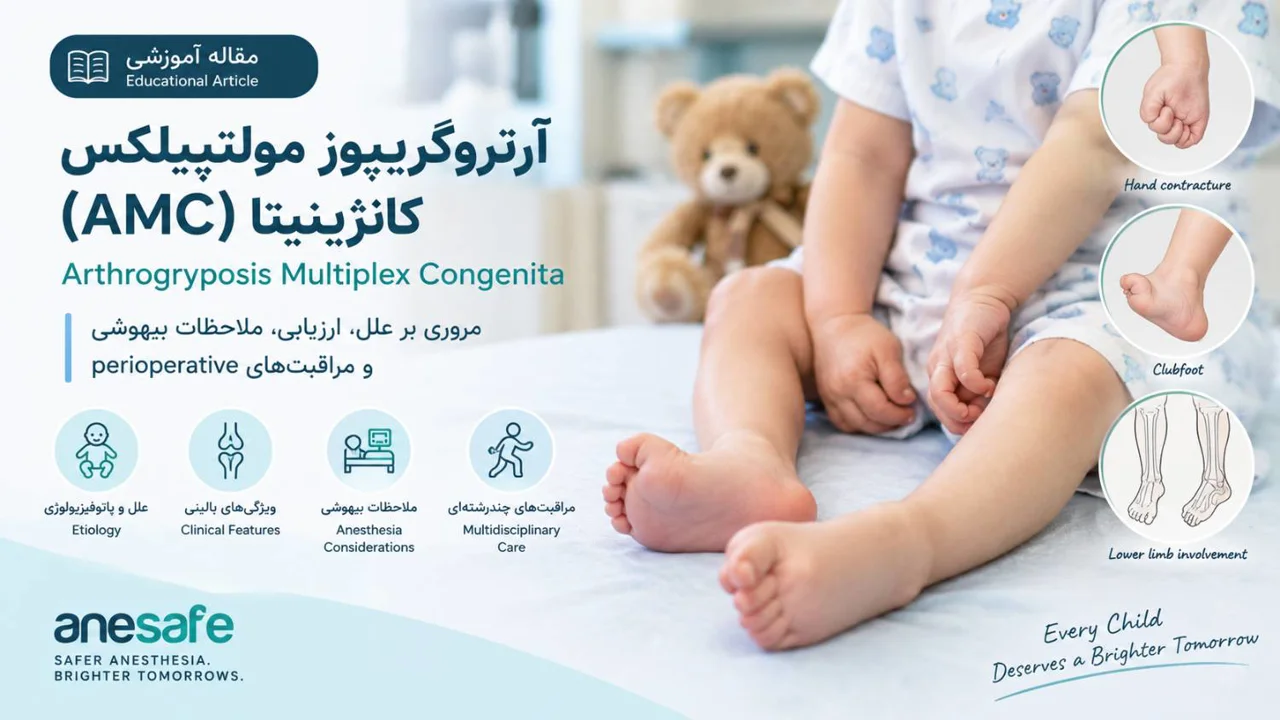 آرتروگریپوز مولتیپلکس کانجنیتا (AMC): Arthrogryposis Multiplex Congenita