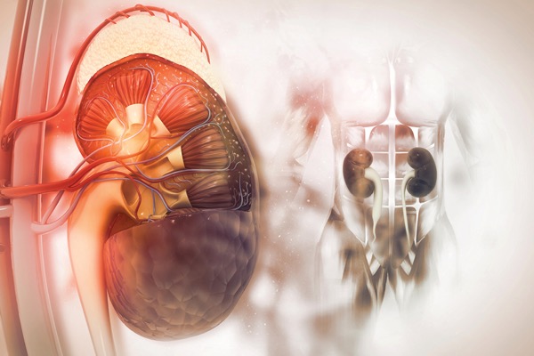 خطر آسیب حاد کلیه پس از جراحی غیرقلبی بدنبال استفاده از فنیل افرین حین عمل برای درمان افت فشار خون