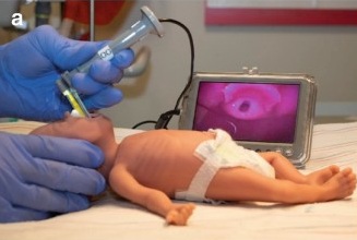 ویدیو لارنگوسکوپی نوزادان؛ از شواهد علمی تا اجرای بالینی – کجا ایستاده‌ایم؟