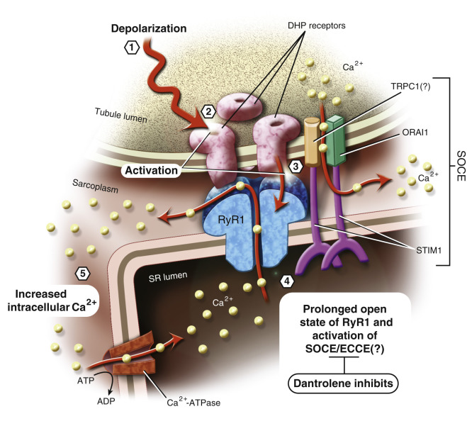 هيپرترمي بدخيم