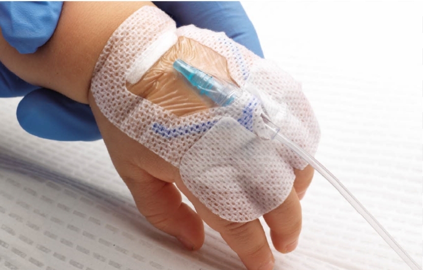 دسترسی وریدی کودکان و نوزادان