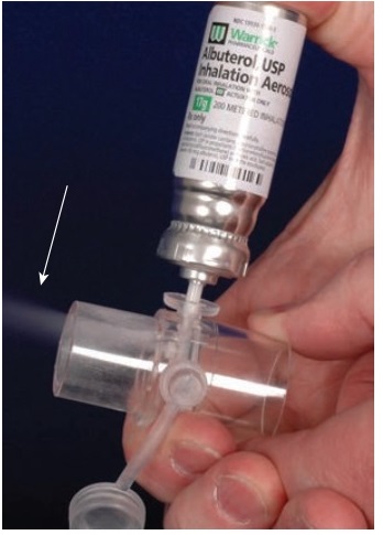 مدیریت برونکواسپاسم در طی بیهوشی عمومی